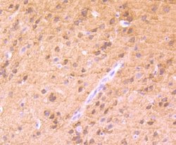 PKC alpha (p Thr638) Rabbit anti-Human, Mouse, Rat, Clone: JF0964, Novus